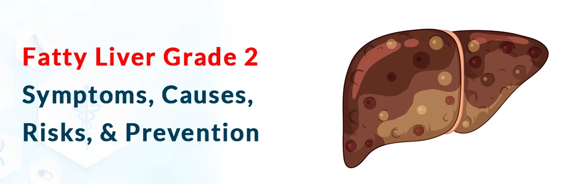 What Are the Symptoms and Causes of Fatty Liver Grade 2?